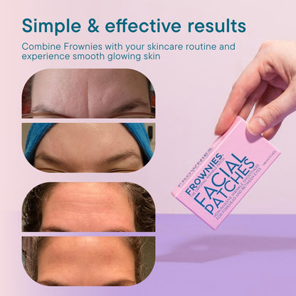 Frownies Forehead & Between the Eyes Wrinkle Patches, 144 Count Frownies