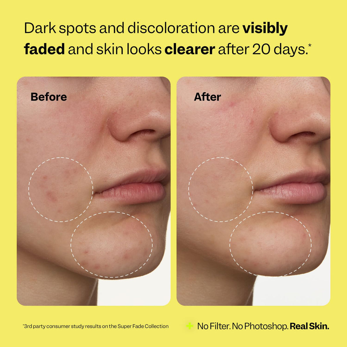 Peach Slices - Super Fade Discoloration Serum for Face (1.01 oz) - Dark Spots, Hyperpigmentation, Uneven Skin - Niacinamide Serum - Tranexamic Acid - Vegan & Cruelty Free - Korean Skin Care & Beauty Peach Slices