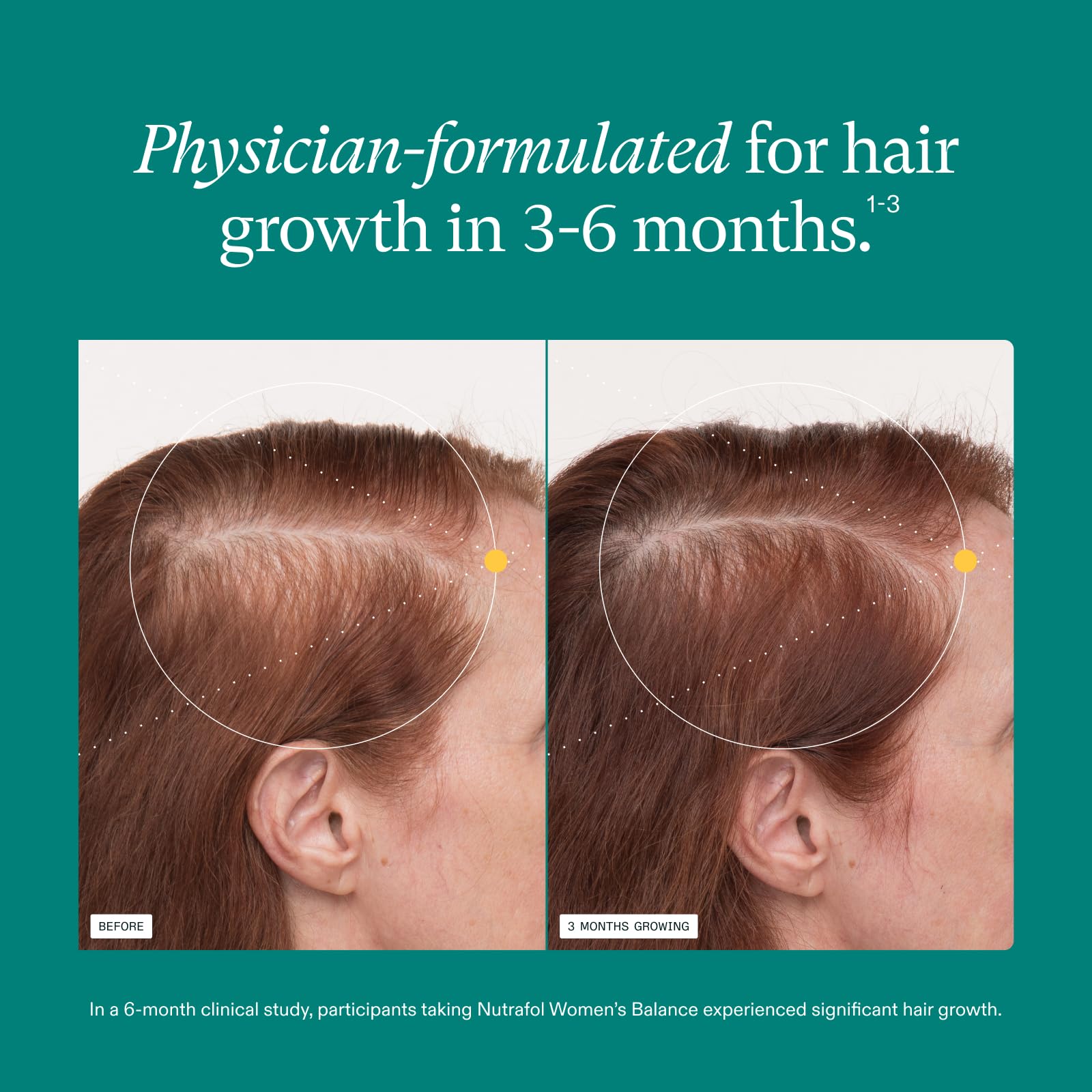 Nutrafol Women's Balance Hair Growth Supplements, Ages 45 and Up, Clinically Proven for Visibly Thicker Hair and Scalp Coverage, Dermatologist Recommended - 1 Month Supply Nutrafol buy australia supplements
