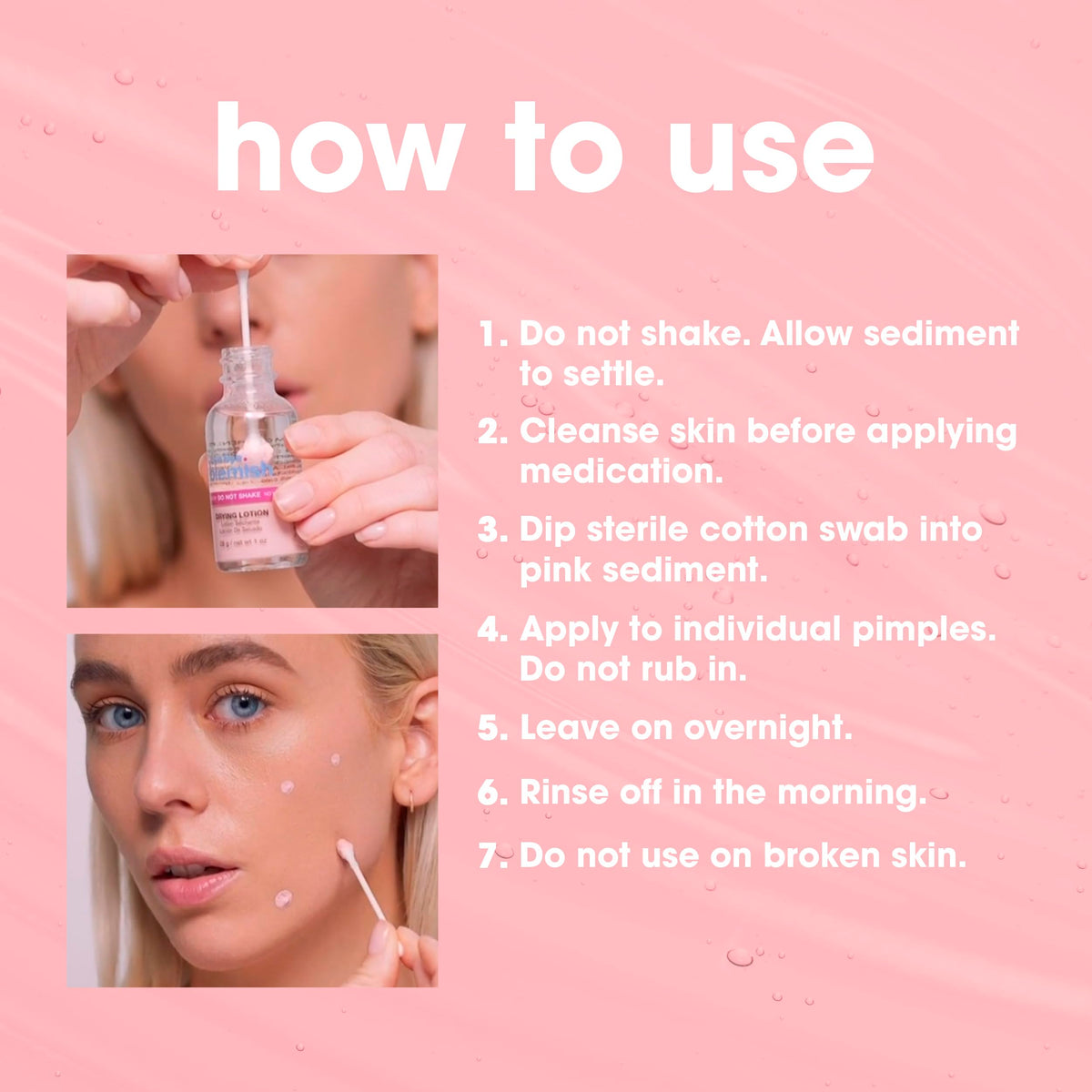 Bye Bye Blemish Acne Drying Lotion, Reduce Pimples Overnight 1oz, 1-Pack Bye Bye Blemish