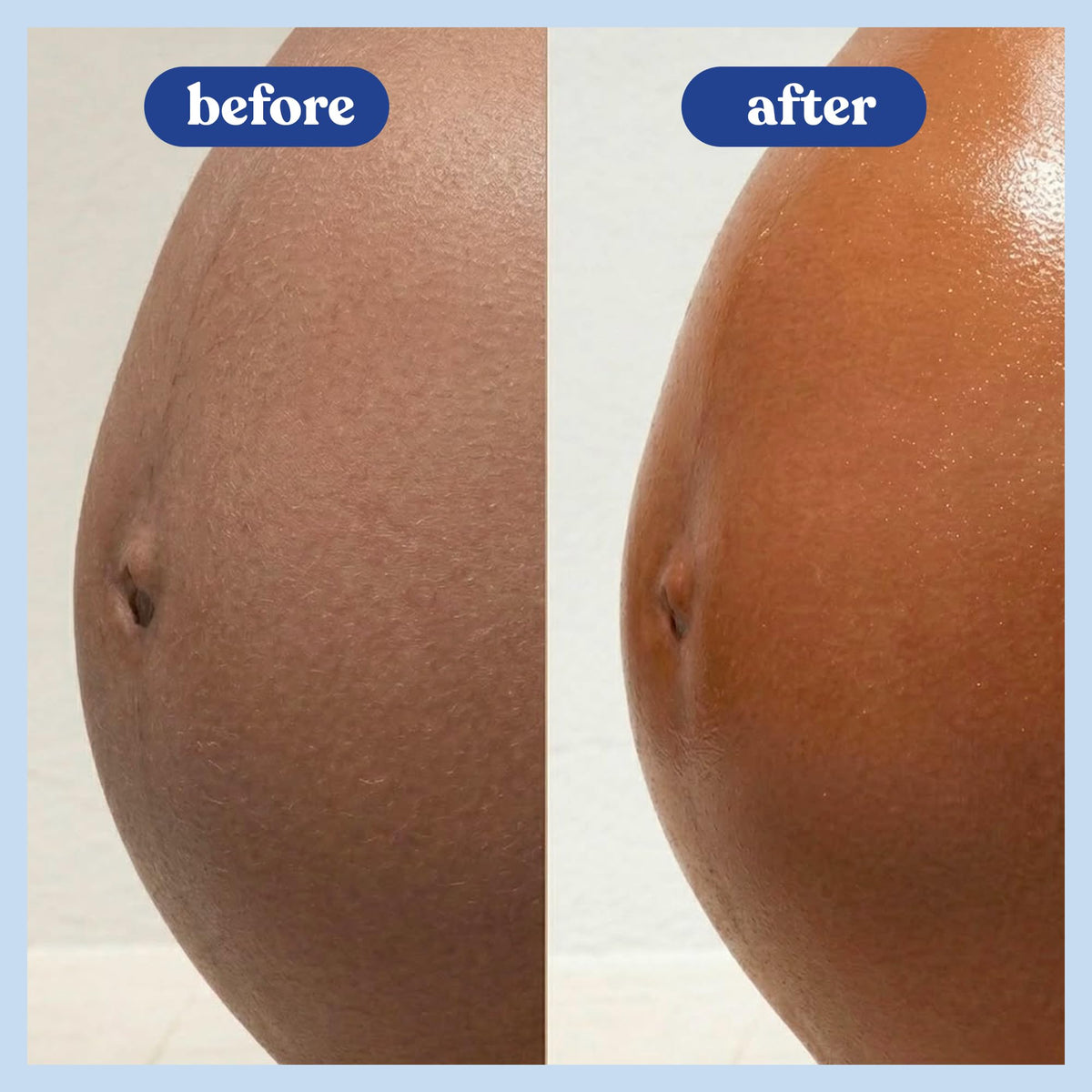 Bumpology Bump Butter, Hydrating Balm for Pregnancy, Stretch Marks, 4 oz Bumpology