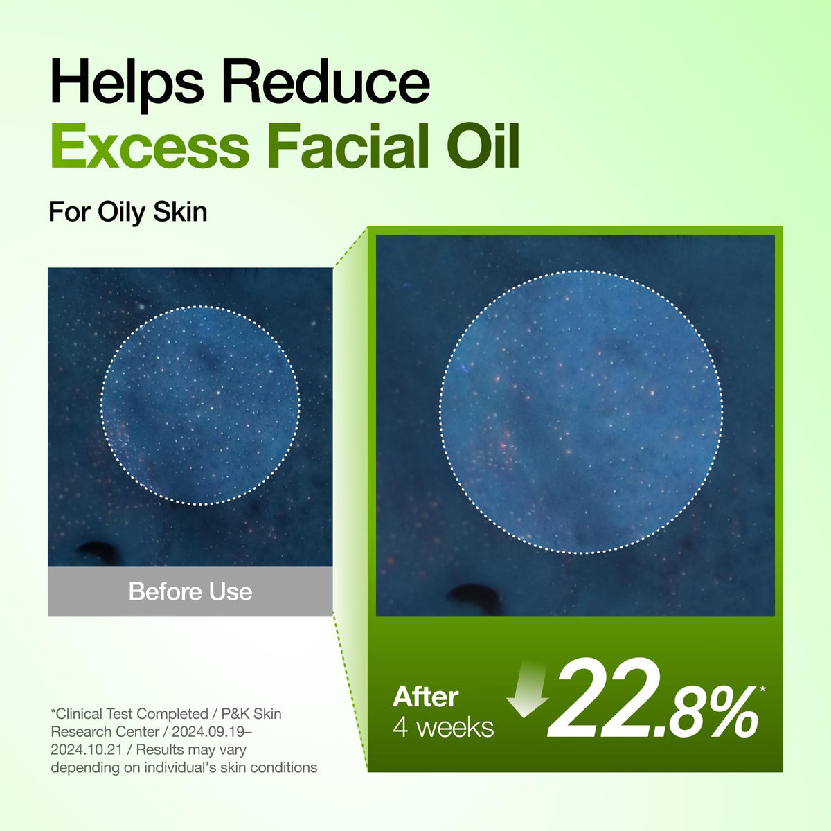 Anua Azelaic Acid 10 Hyaluron Redness Soothing Serum, 1.01 fl oz ANUA