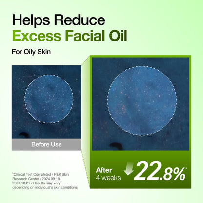 Anua Azelaic Acid 10 Hyaluron Redness Soothing Serum, 1.01 fl oz ANUA