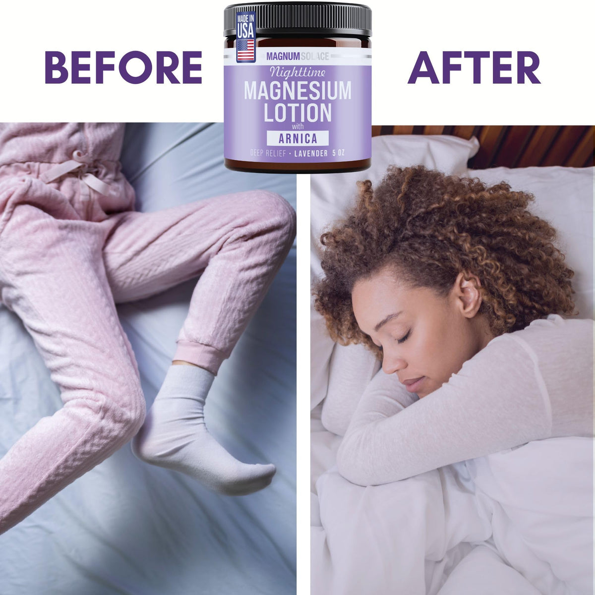 Magnum Solace Nighttime Magnesium Lotion with Arnica – Highly Concentrated Magnesium for Muscles & Joints – Apply to Legs or Feet Before Bed – Skin-Friendly Magnum Solace