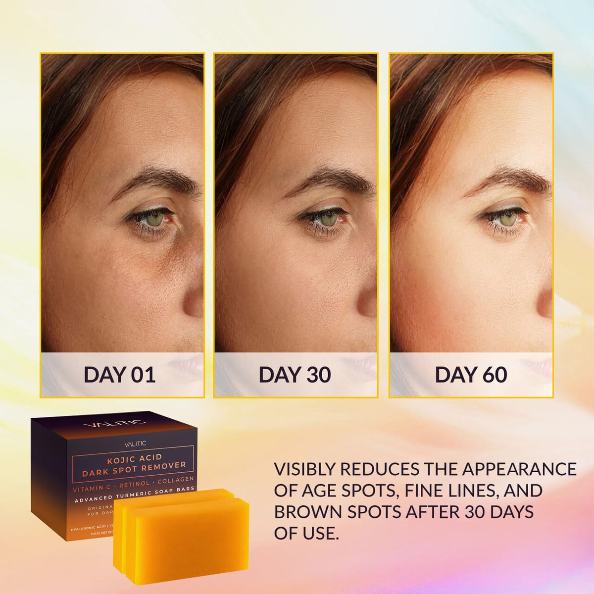VALITIC Kojic Acid Dark Spot Remover Soap Bars, Turmeric Bar Soaps 2 Pack VALITIC