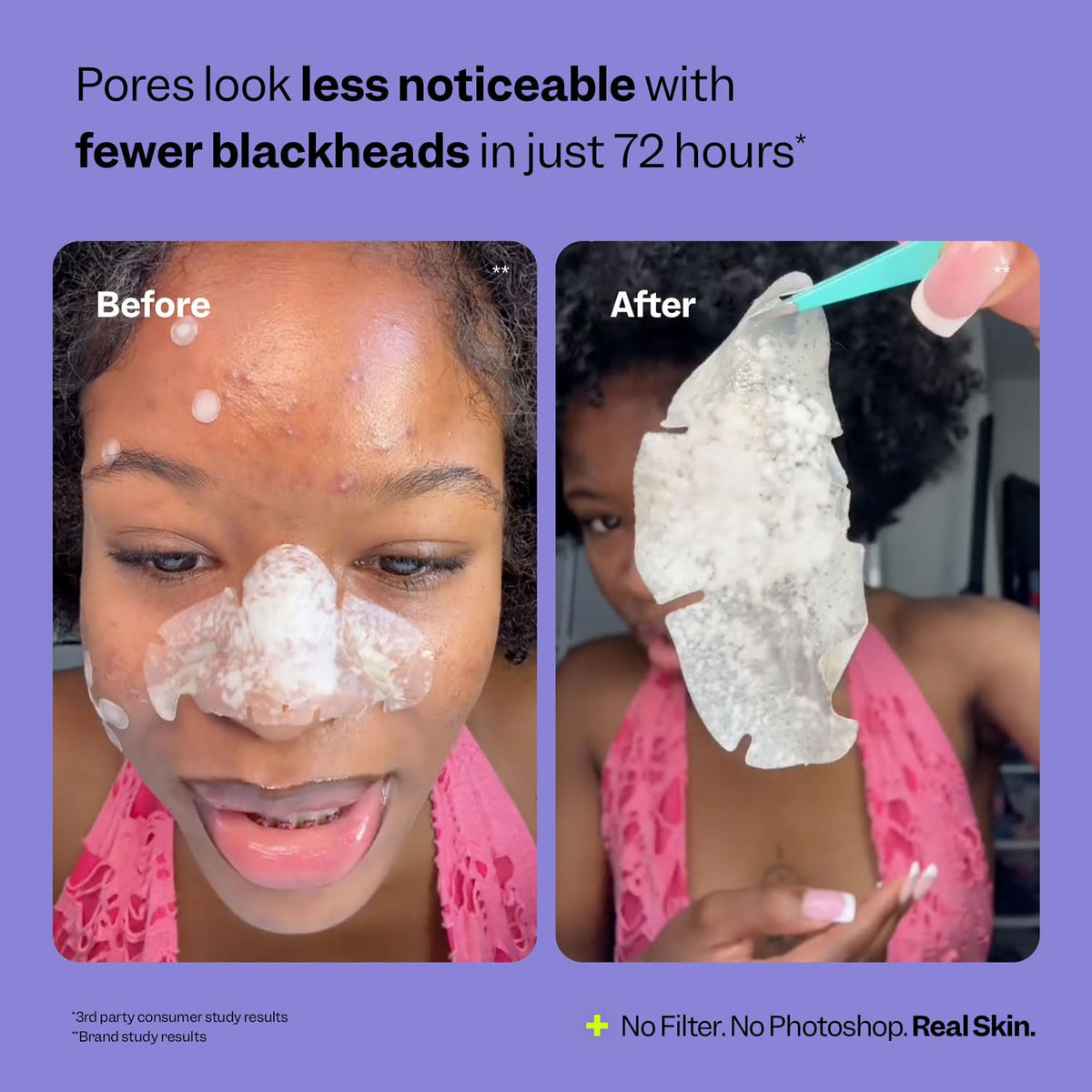 Peach Slices - Nose Pore Patches (7 ct) - Overnight Blackhead Remover - Pore Strips - Absorbs Gunk - Thin, Flexible & Painless - Hydrocolloid Patches - Vegan & Cruelty Free - Korean Skin Care & Beauty Peach Slices