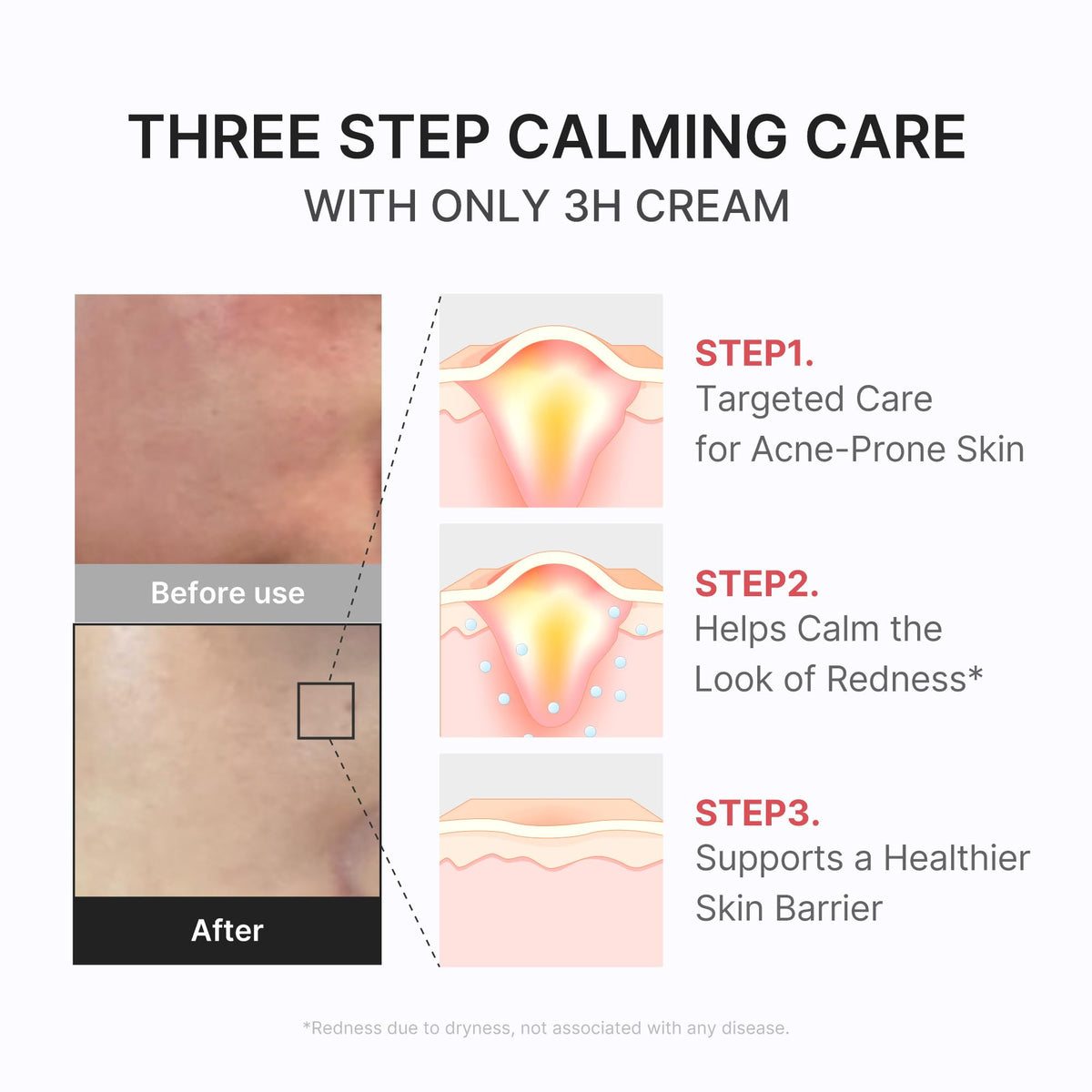 medicube 3H Daily Relief Cream for All Skin Types & After Spot Care medicube