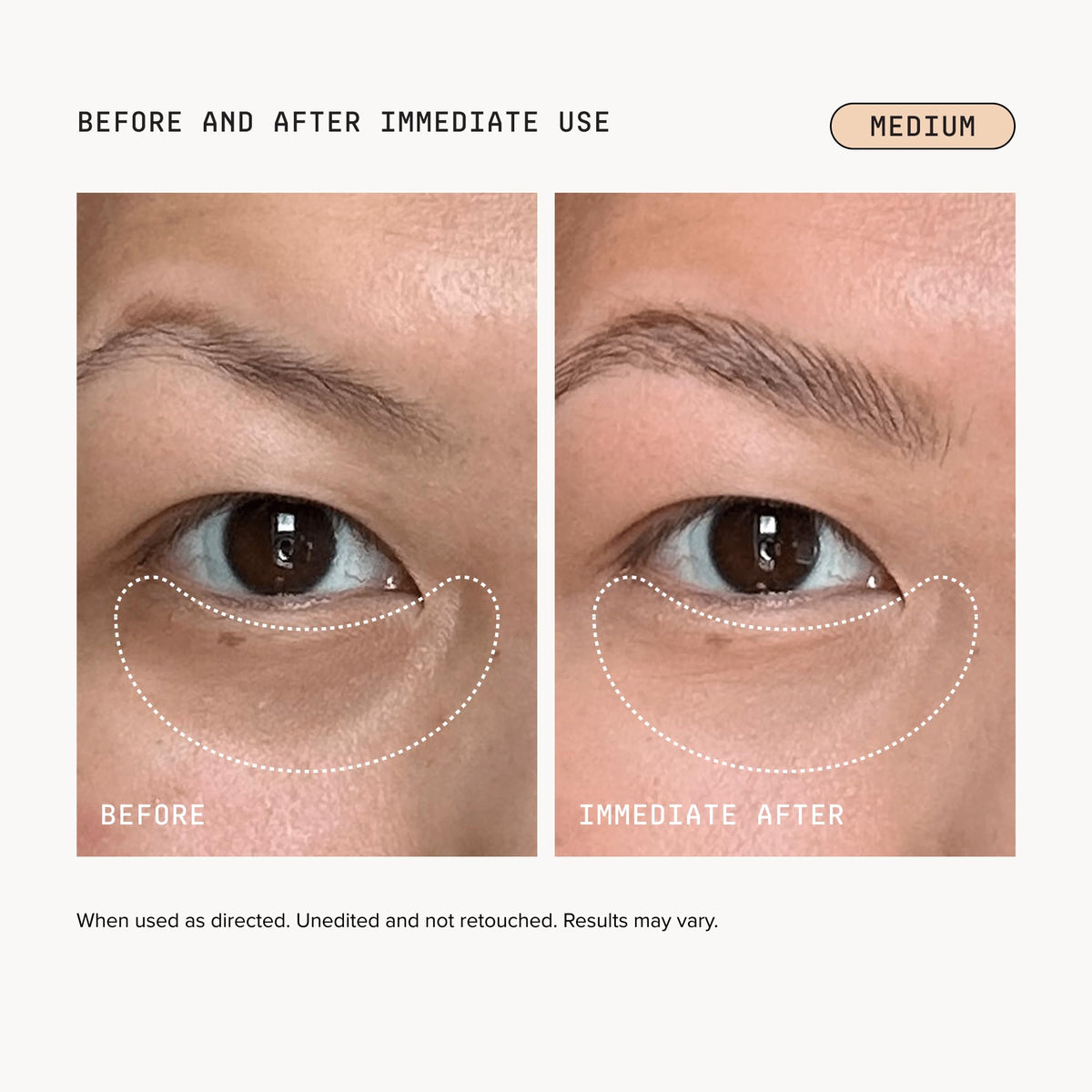 DRMTLGY Luminous Eye Corrector SPF 41 Medium | Undereye Corrector DRMTLGY