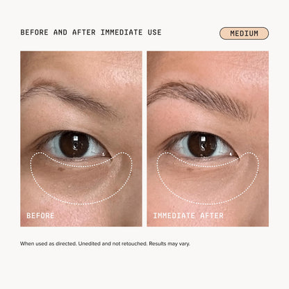 DRMTLGY Luminous Eye Corrector SPF 41 Medium | Undereye Corrector DRMTLGY