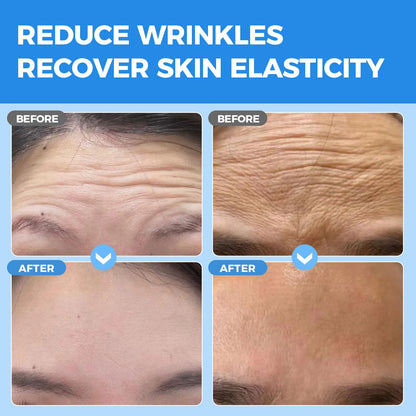 Okela Forehead Wrinkle Patches Overnight 20 pcs with Collagen, Anti Wrinkle Patches, Forehead Wrinkles Beauty Treatment Okela