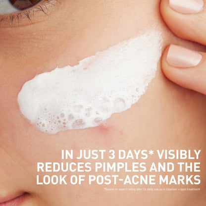 CeraVe Clay to Foam Acne Face Wash, Salicylic Acid Spot Treatment, 4 Oz CeraVe