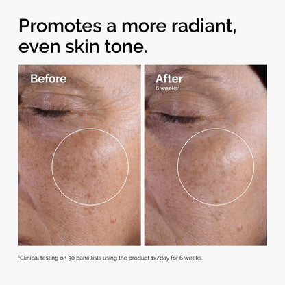 The Ordinary Glycolic Acid 7% Exfoliating Toner, Brightening and Smoothing Daily Toner for More Even-Looking Skin Tone, 8.1 Fl Oz The Ordinary