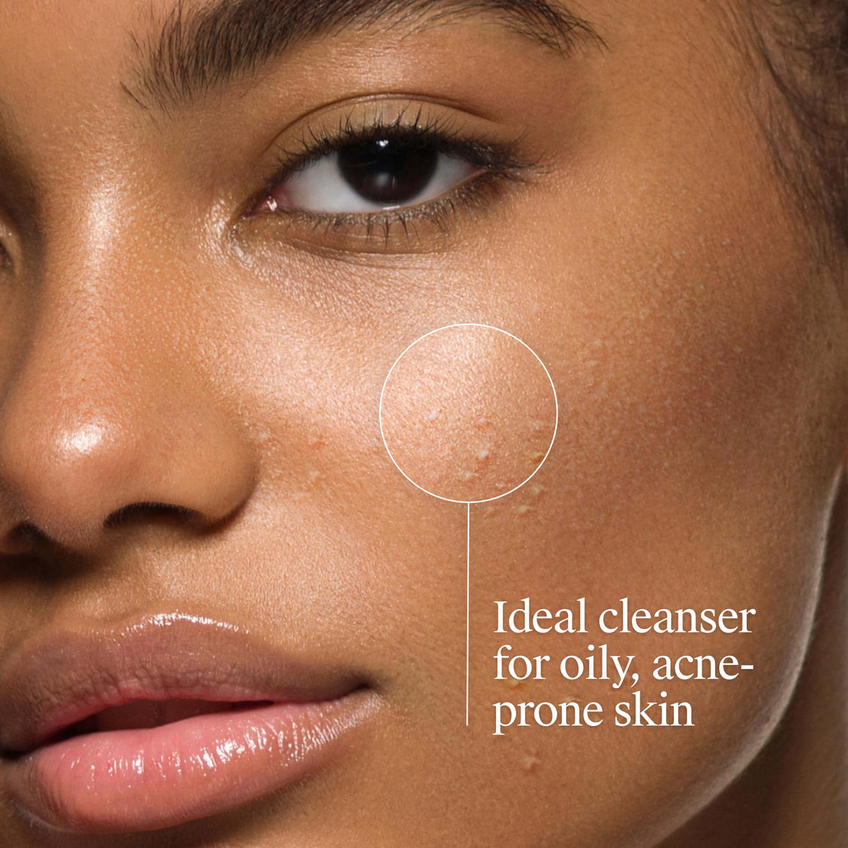 Neutrogena Oil Free Acne Face Wash, 9.1 fl. oz Neutrogena