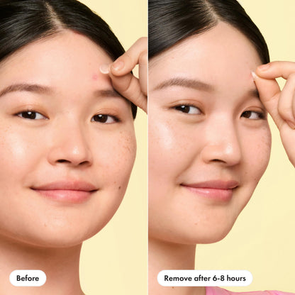 Hero Cosmetics Mighty Patch Mini Invisible+ Acne Pimple Patches, 30 Ct Mighty Patch