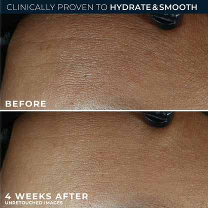 RoC Retinol Correxion Max Daily Hydration Face Moisturizer, Hyaluronic Acid RoC