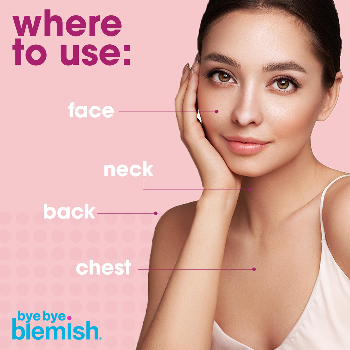 Bye Bye Blemish Acne Drying Lotion, Reduce Pimples Overnight 1oz, 1-Pack Bye Bye Blemish