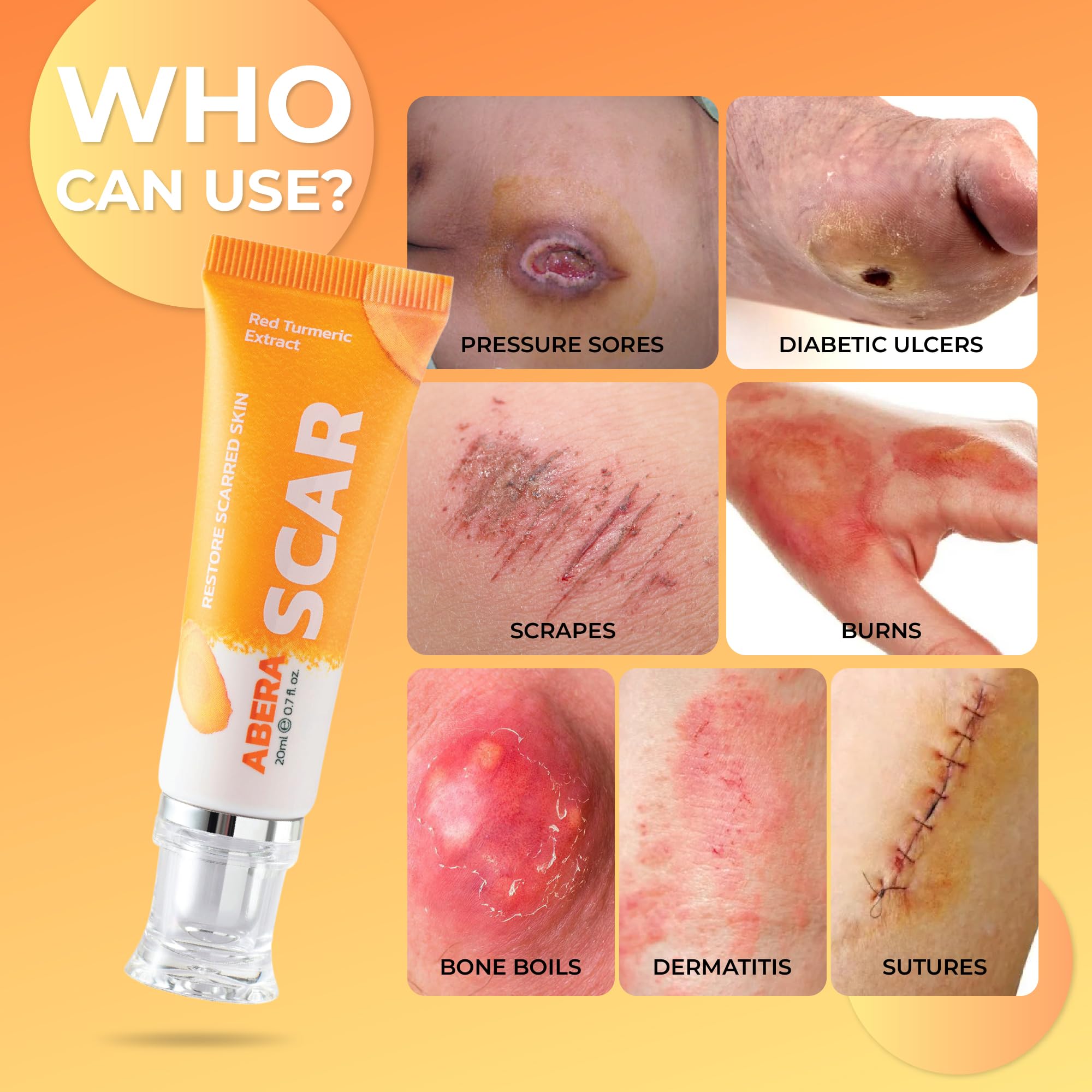 ABERA Scar Removal Cream for Women and Men - Rapid Repair of New Old Scars, Spots, Burns All Natural Treatment with Vitamin E, Alanine, Collagen (1 Box + 3 Eye Patch) ABERA buy australia supplements
