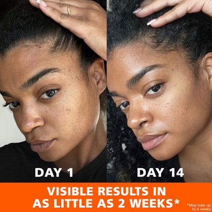 Palmer's Skin Success Anti-Dark Spot Fade Cream with Vitamin E and Niacinamide, for All Skin Types 2.7 Ounce Palmer's