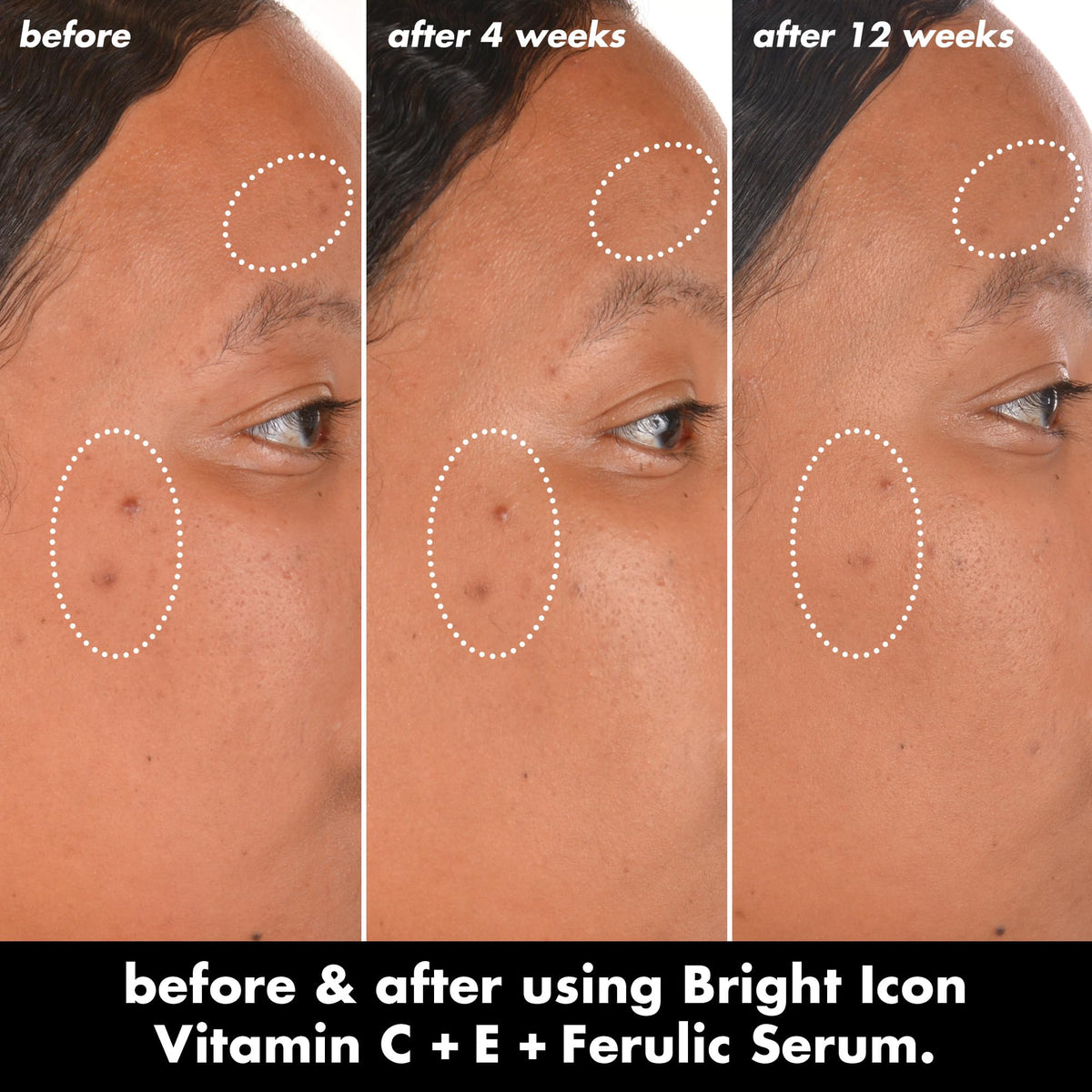 e.l.f. SKIN Bright Icon Vitamin C + E + Ferulic Serum, 1 oz e.l.f.