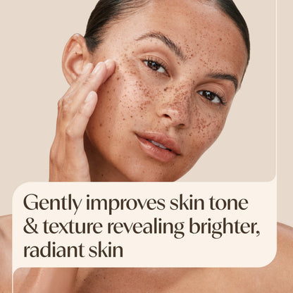 Aveeno Positively Radiant Clear Complexion Acne Face Moisturizer, 4 fl. oz Aveeno