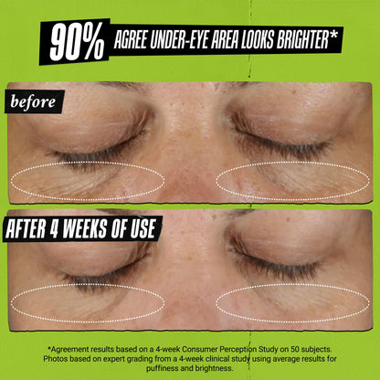 Kiehl's Avocado Eye Treatment, Nourishing and Hydrating Eye Cream, Avocado Oil and Caffeine to Energize and Invigorate Skin, Tired Eyes Kiehl's