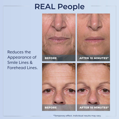 Plexaderm Eye Serum Pump - Visibly Reduces Bags, Wrinkles & Dark Circles Plexaderm