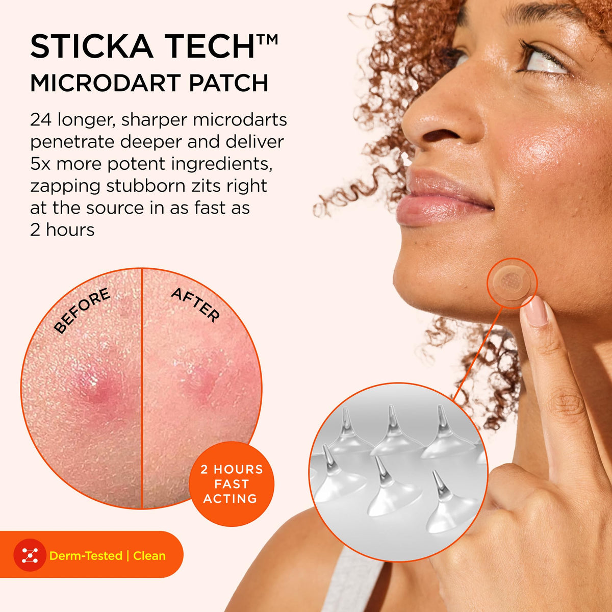 ZitSticka Killa Acne Extra Strength Microdart Pimple Patches For Face, 4 Ct ZitSticka