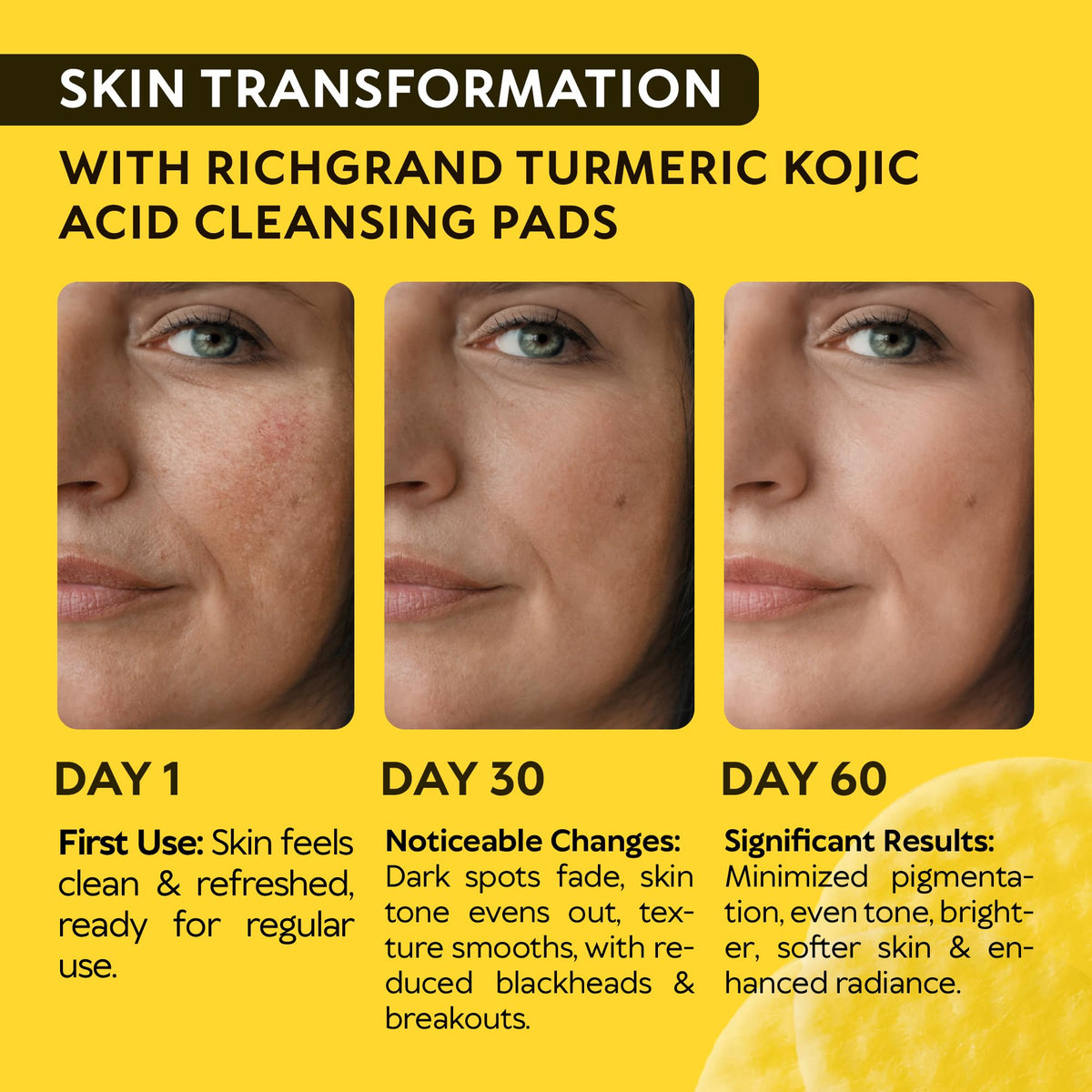 Turmeric Kojic Acid Cleansing Pads for Face - Exfoliating Sponges with Vitamin C & Lemon - Foaming Facial Wash for Glowing Skin & Uneven Tone Support - Gentle Daily Scrub RICHGRAND