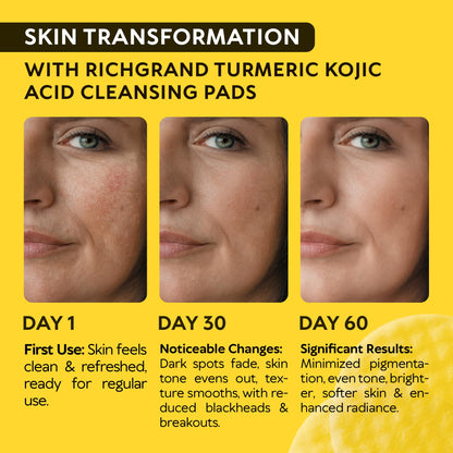 Turmeric Kojic Acid Cleansing Pads for Face - Exfoliating Sponges with Vitamin C & Lemon - Foaming Facial Wash for Glowing Skin & Uneven Tone Support - Gentle Daily Scrub RICHGRAND