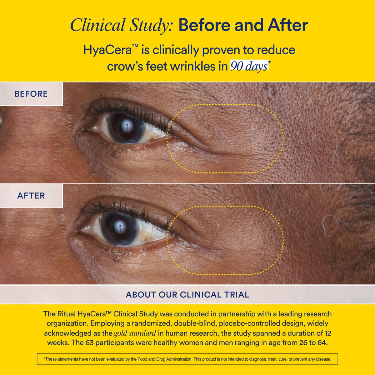 Ritual Hyaluronic Acid Skin Supplement - With Hyabest® and Ceratiq® - HyaCera Clinically Proven to Reduce Wrinkles, Fine Lines & Improve Skin Smoothness Ritual