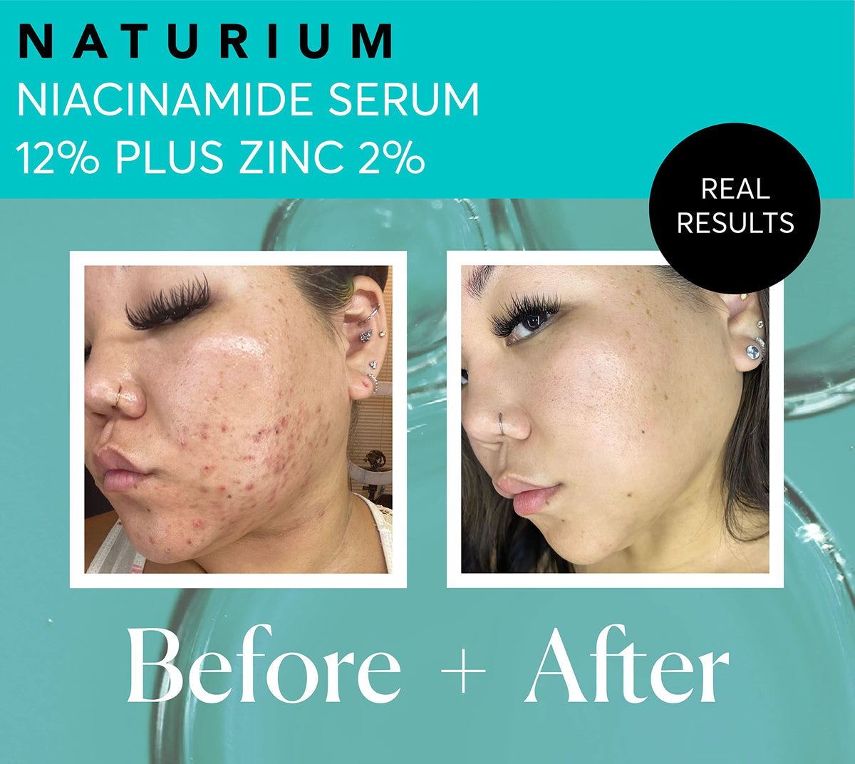 Naturium Niacinamide Serum 12% Plus Zinc 2%, 1 fl oz Naturium