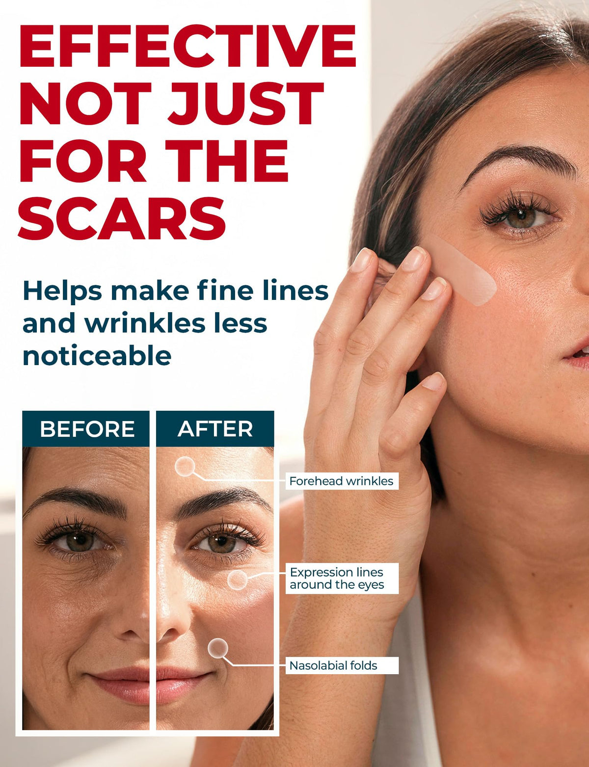 Medical Grade Silicone Scar Tape - 1.6"x150" - Effective Scar Removal MYHELP