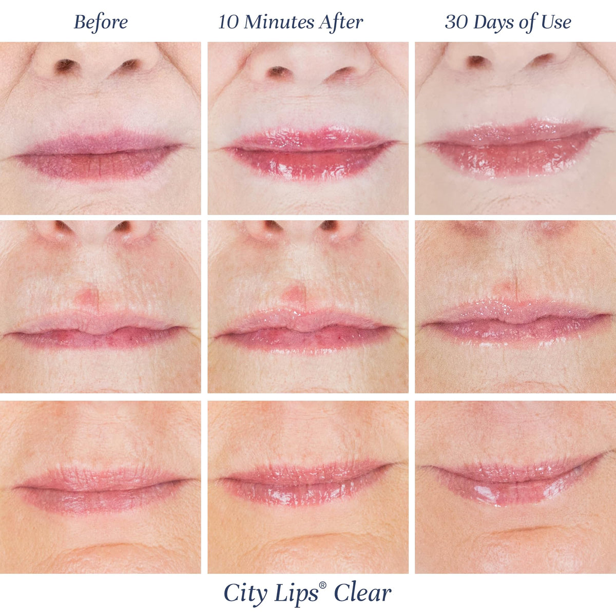 City Beauty City Lips Clear - Plumping Lip Gloss - Hydrate & Volumize - High Shine Lip Plumper - Hyaluronic Acid & Peptides Visibly Smooth Lip Wrinkles - Cruelty-Free (Clear, Pack of 1) City Beauty