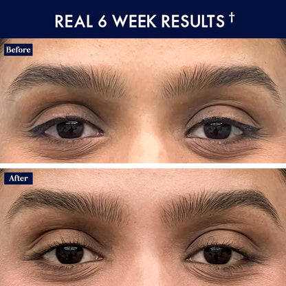 SugarbearPRO LashCare™ + BrowCare™ Vitamin Serum Duo | Peptides, MSM & Biotin | 3-Month Supply Each | Vegan Formula for Fuller, Healthier-Looking Lashes & Brows