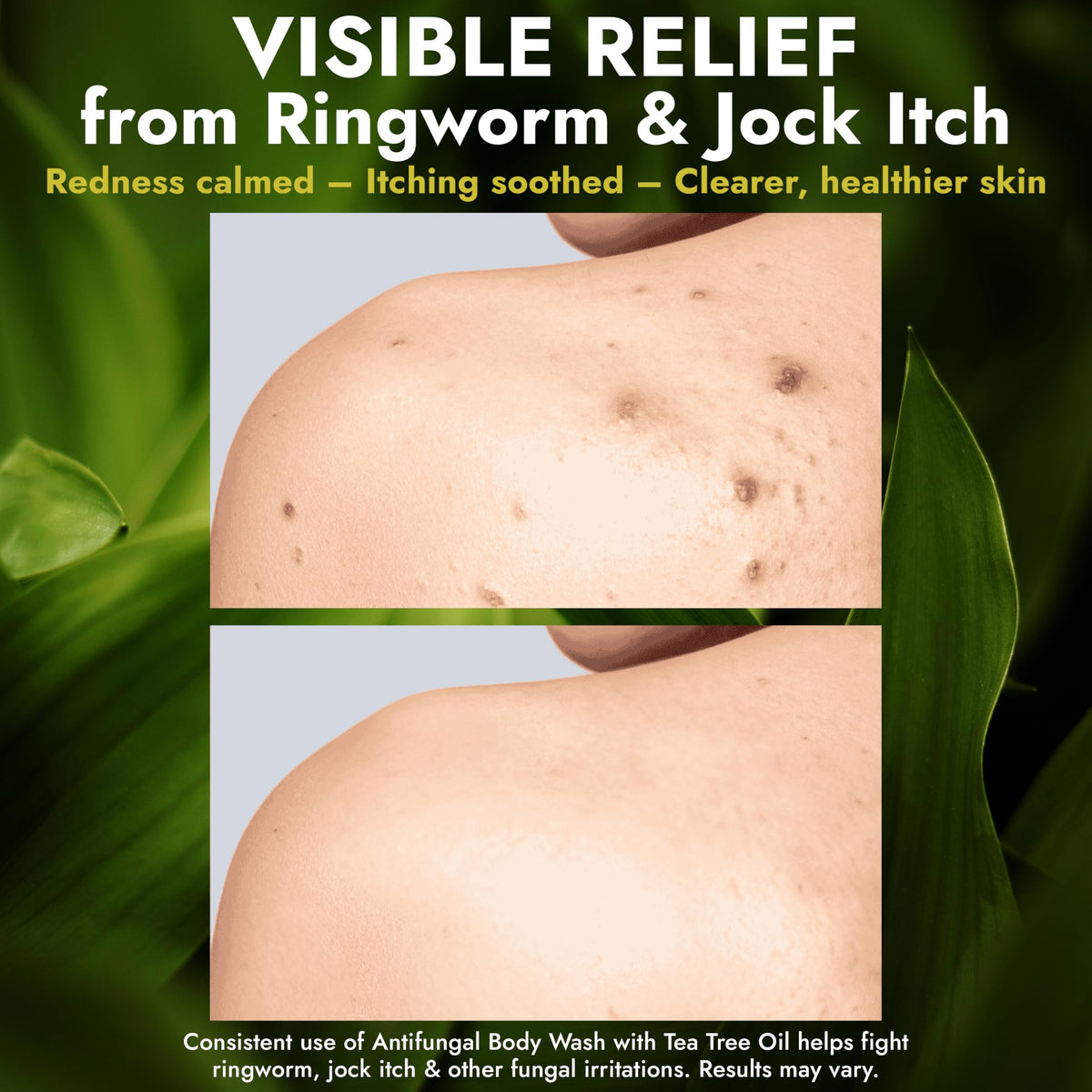Antifungal Body Wash with Tea Tree Oil for Ringworm & Jock Itch w/Scrubber Terramed Just Think Comfort