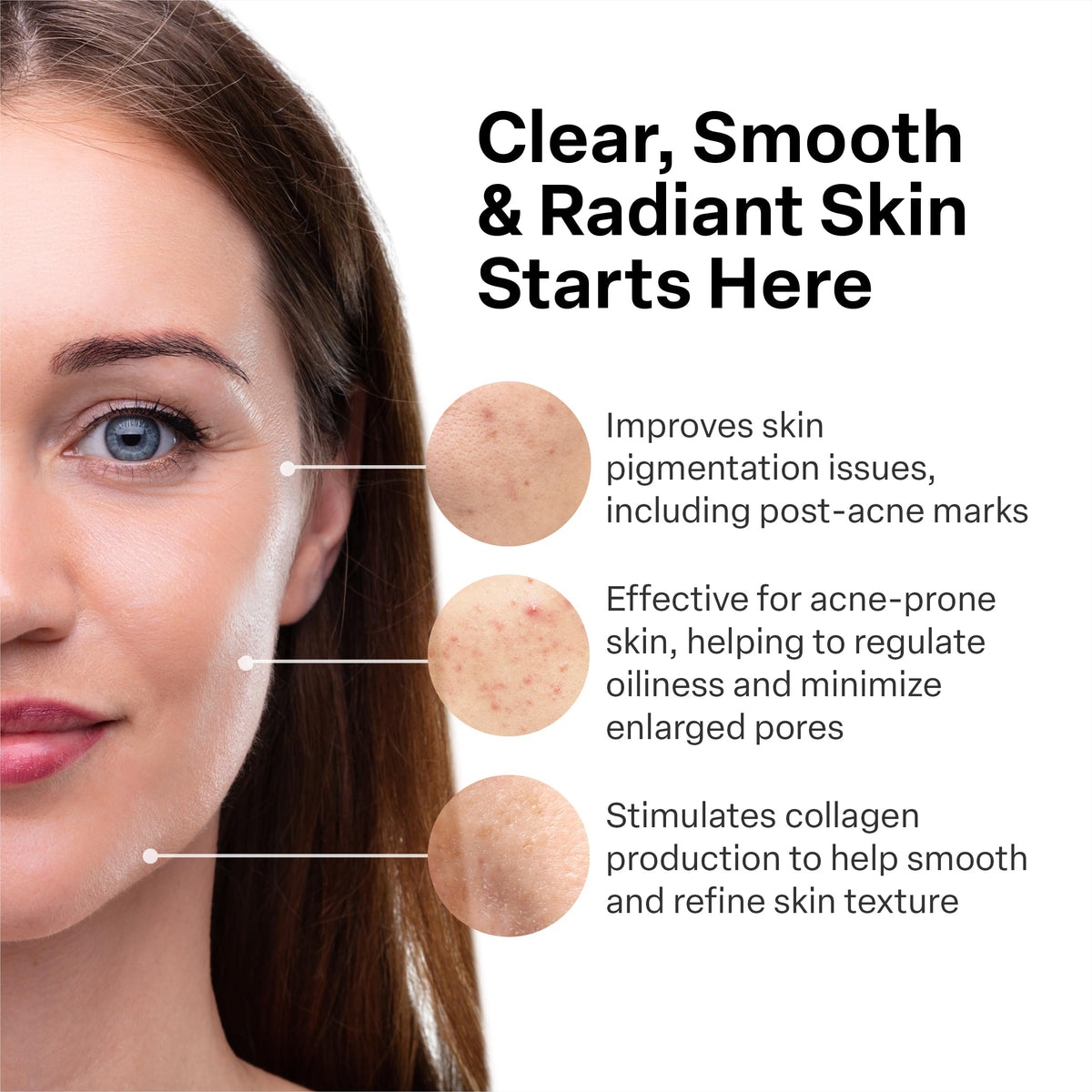 A313 Retinol Cream | Vitamin A Pommade (Ointment), 50g A313