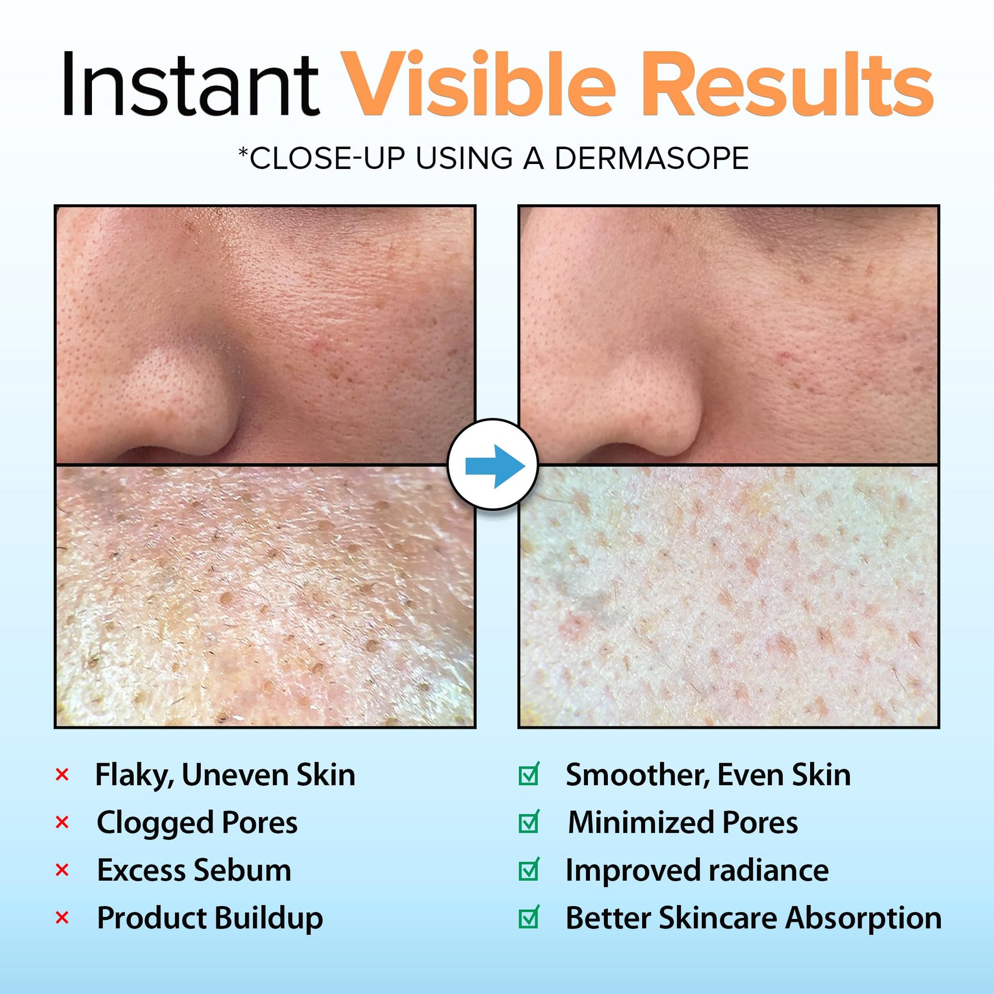 Ebanel Brightening Peeling Gel with Cotton Cellulose, Rice, Papaya, Centella, Hyaluronic Acid for Face and Body, Gentle Exfoliating Face Scrub Gel Peel Wash, Deep Pore Cleanser Minimizer Exfoliator Ebanel buy australia supplements