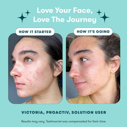 Proactiv 3 Step Acne Treatment - Benzoyl Peroxide Face Wash, Repairing Acne Spot Treatment for Face and Body, Exfoliating Toner - 30 Day Complete Acne Skin Care Kit Proactiv
