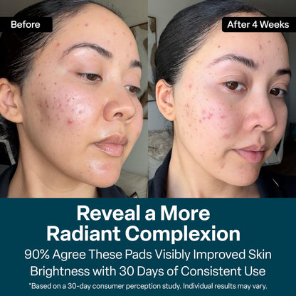 QRxLabs Glycolic Acid Pads - 20% Resurfacing Pads AHA for Face & Body - Exfoliates Skin Surface and Reduces Appearance of Fine Lines and Wrinkles - Acne Treatment Clearing - Daily Pads - 50ct QRxLabs