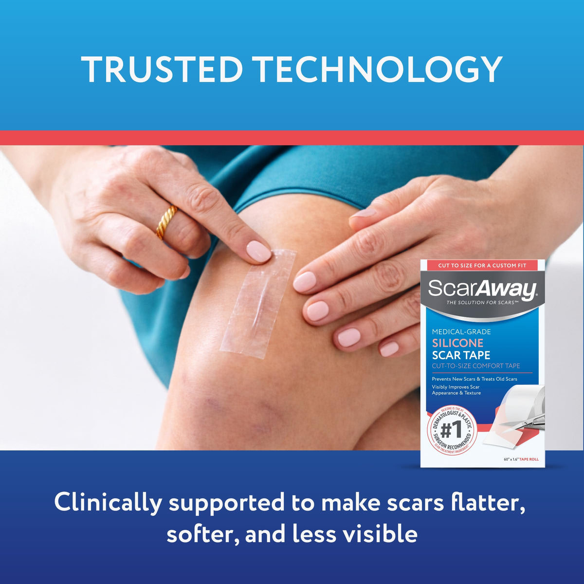 ScarAway Clear Silicone Scar Tape, Medical-Grade Cut-to-Size Silicone Strip for Surgery, Burn, Hypertrophic & Keloid Scars, Self-Adhesive, Water-Resistant, 60” x 1.6” Tape Roll ScarAway