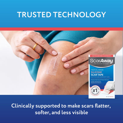 ScarAway Clear Silicone Scar Tape, Medical-Grade Cut-to-Size Silicone Strip for Surgery, Burn, Hypertrophic & Keloid Scars, Self-Adhesive, Water-Resistant, 60” x 1.6” Tape Roll ScarAway