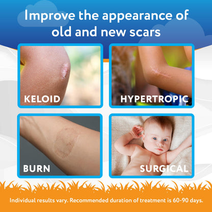 ScarAway Kids Scar Gel, Medical-Grade Silicone Scar Gel, Clear, 6g ScarAway