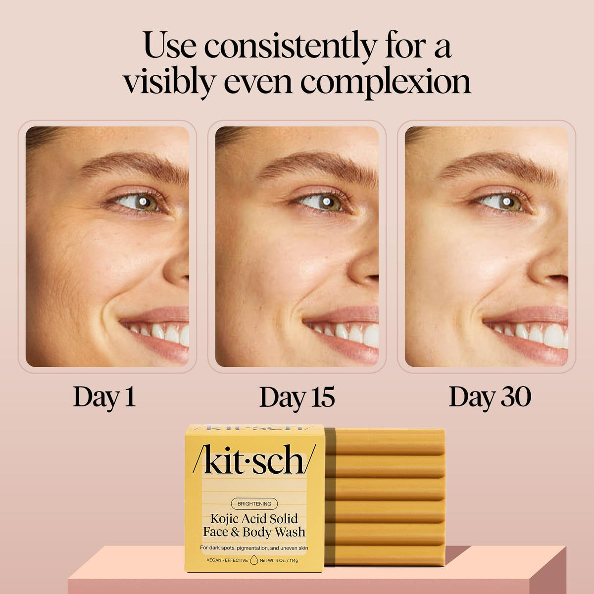 Kitsch Kojic Acid Soap – Turmeric Soap Bar – Made in USA, 4 oz Kitsch