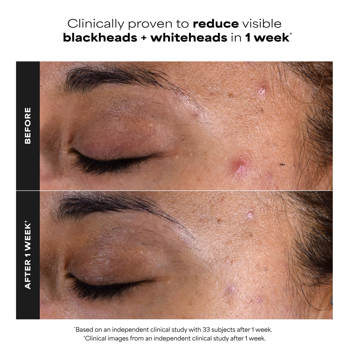 Paula's Choice SKIN PERFECTING 2% BHA Salicylic Acid Exfoliating Pads,10 Ct Paula's Choice