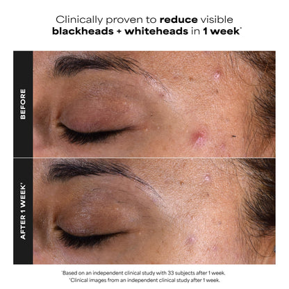 Paula's Choice SKIN PERFECTING 2% BHA Salicylic Acid Exfoliating Pads,10 Ct Paula's Choice