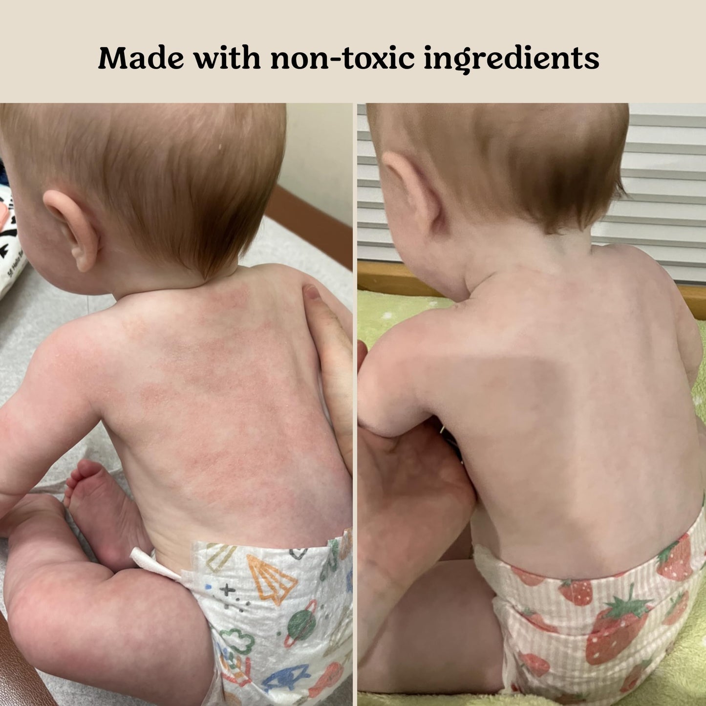 Roe Wellness- Baby Cream Lotion Ointment EWG Verified Non-Toxic Ingredients | Full Body Biome Barrier | Dry Skin, Itch Relief, Moisturizing, All Over Ointment | Toddlers & Kids