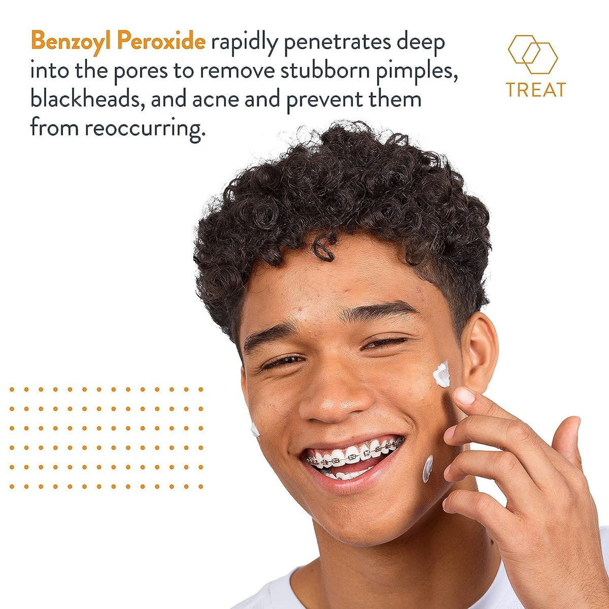 AcneFree Terminator 10 Acne Spot Treatment with Benzoyl Peroxide 10% Maximum Strength Acne Cream Treatment, 1 Ounce - Pack Of 1 AcneFree