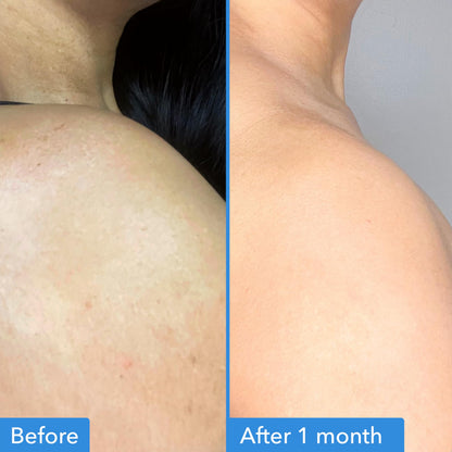 Good Molecules Discoloration Correcting Body Treatment, 4 fl oz Good Molecules
