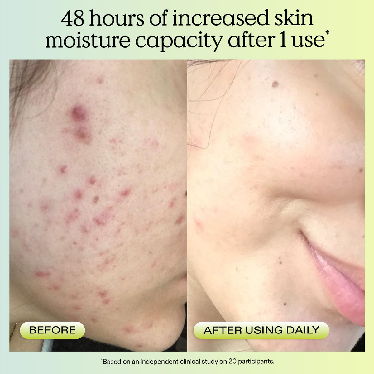KraveBeauty Matcha Hemp Hydrating Cleanser for Dry, Sensitive Skin, 120 mL KraveBeauty