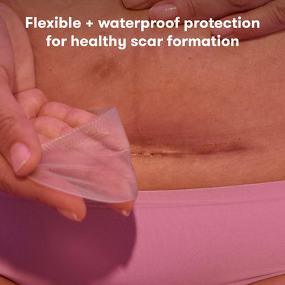 Frida Mom C-Section Silicone Strips for Recovery, Scar Treatment, Essential Frida Mom